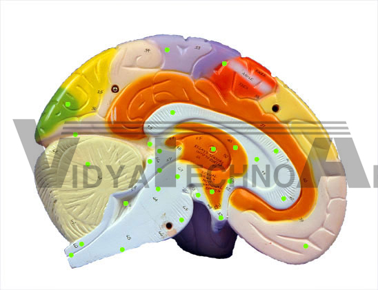 Large Brain-Sagittal Section